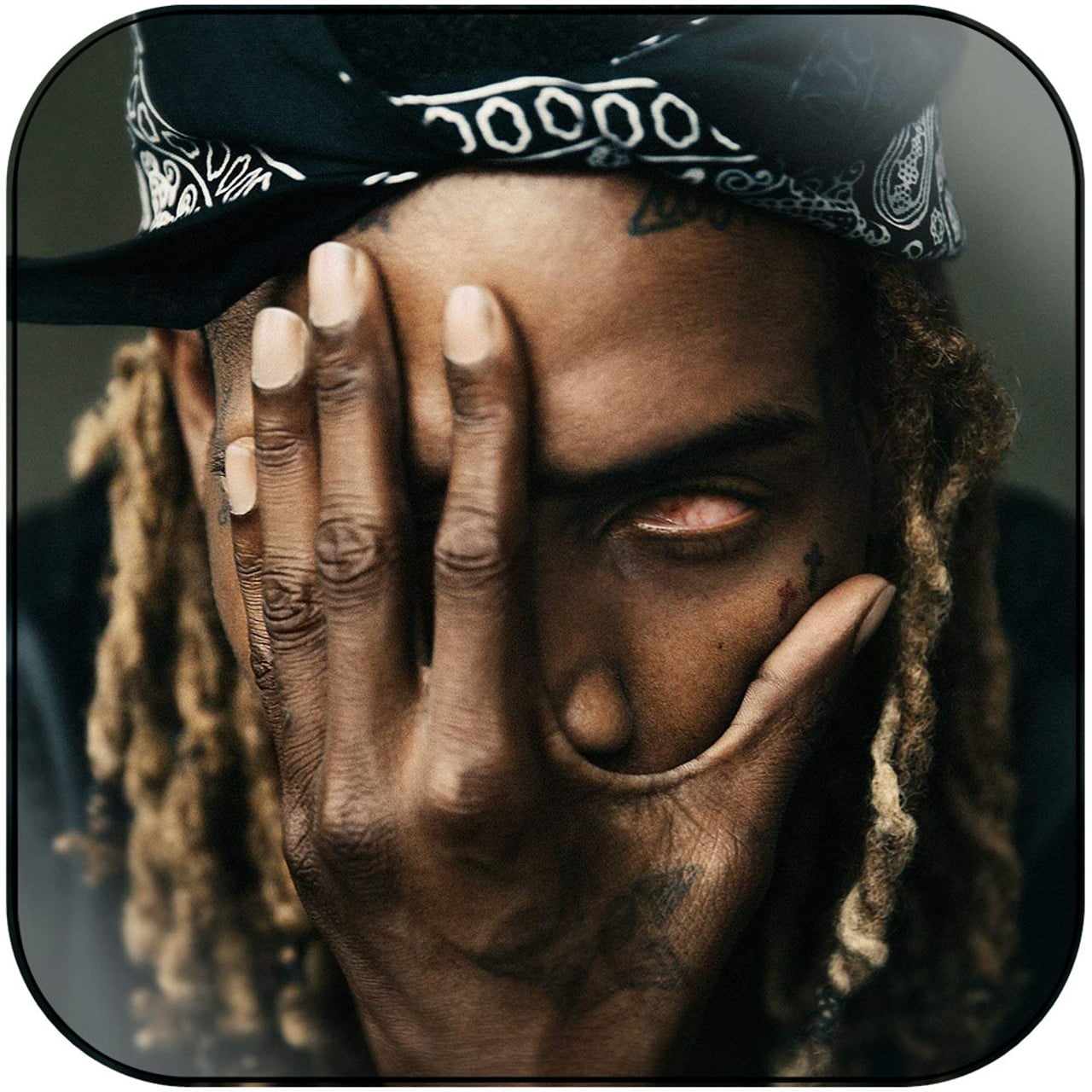 What happened to Fetty Waps eye